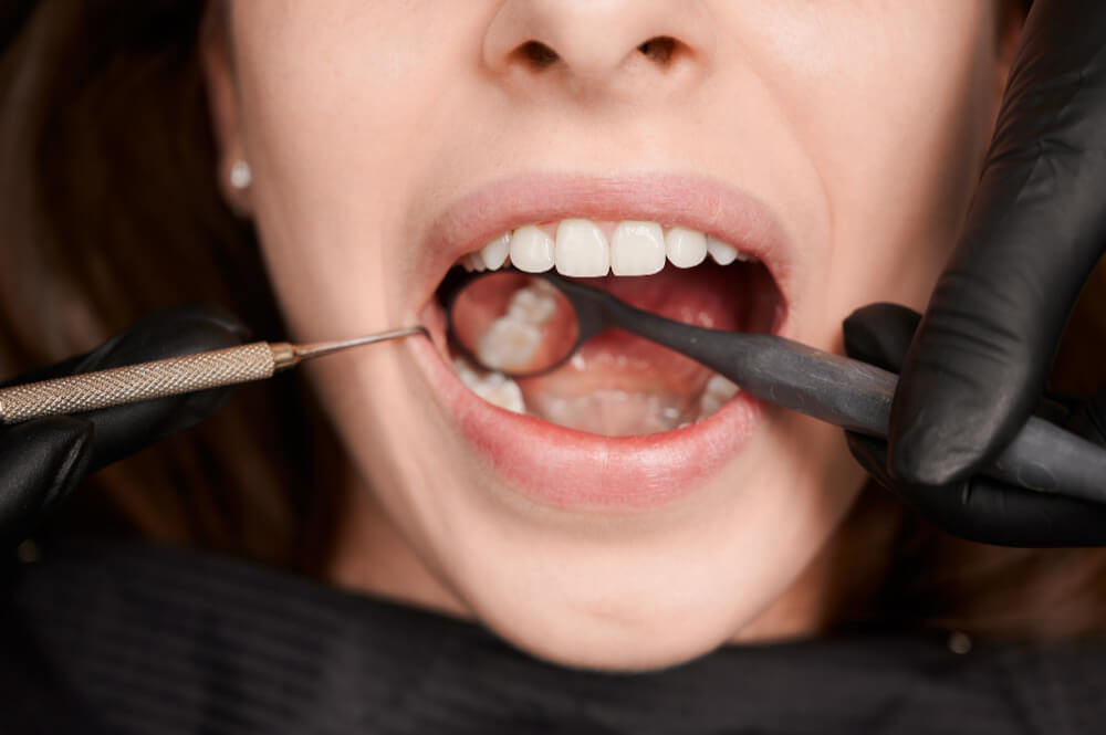 Dental Treatment in Adelaide