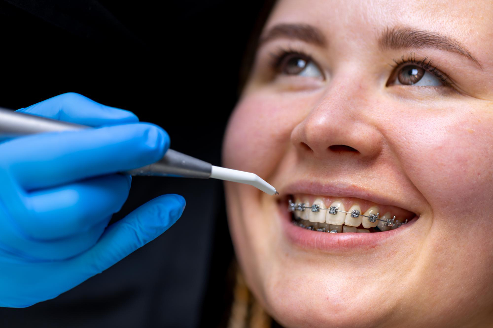 Invisalign provider in Adelaide