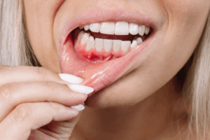 dentist in adelaide 