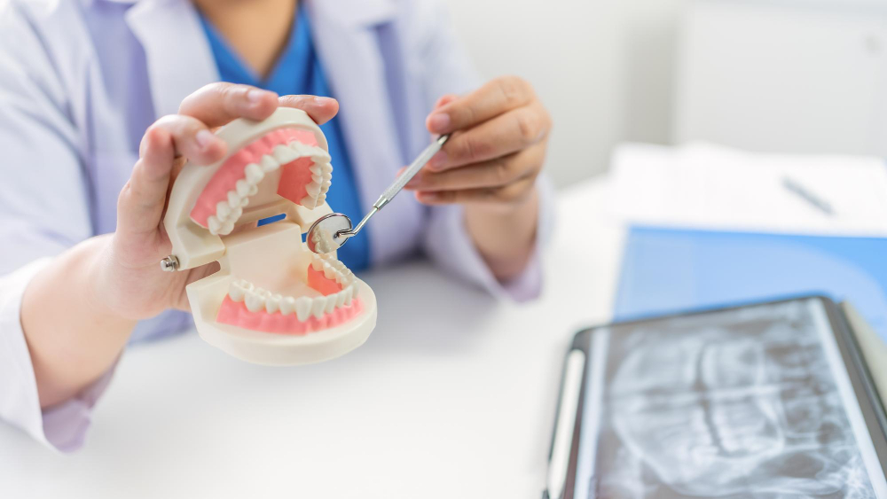 dental implants Adelaide