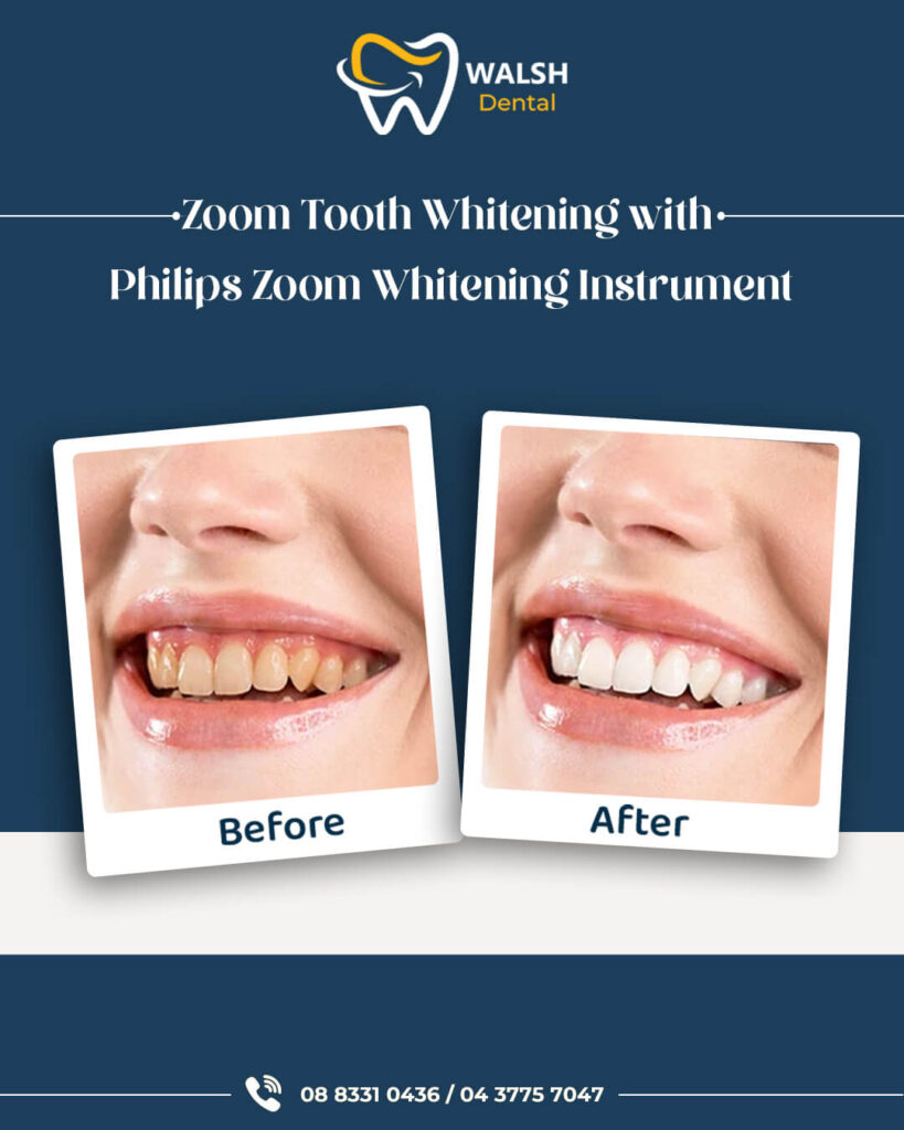 Whitening Dentist Adelaide