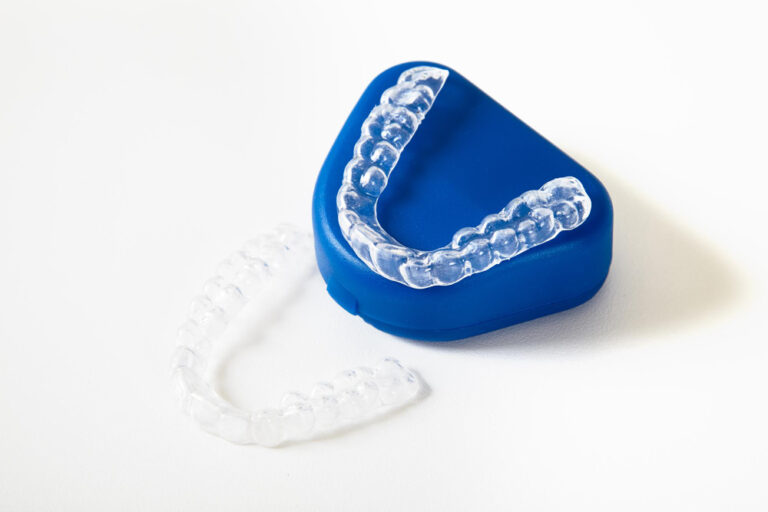 Invisalign in adelaide